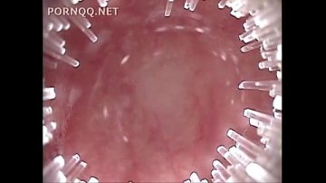 anal scolarita fututa numai